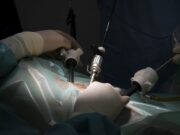 Pushing the Boundaries of Minimally Invasive Arthroscopic Surgery
