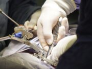 Beyond Fusion: The New Vanguard of Spinal Surgery