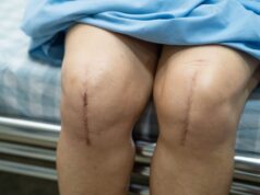 Rationing Joint Replacement Surgeries: Who Gets Priority in a Resource-Limited System?